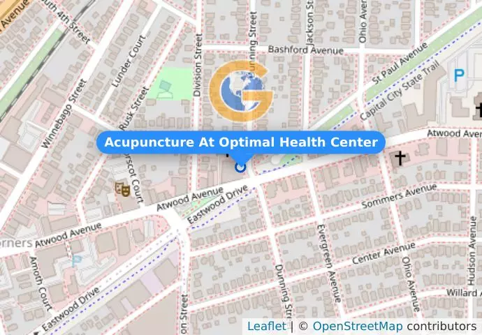 Acupuncture At Optimal Health Center