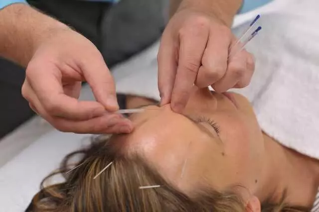 Ardent Living Acupuncture